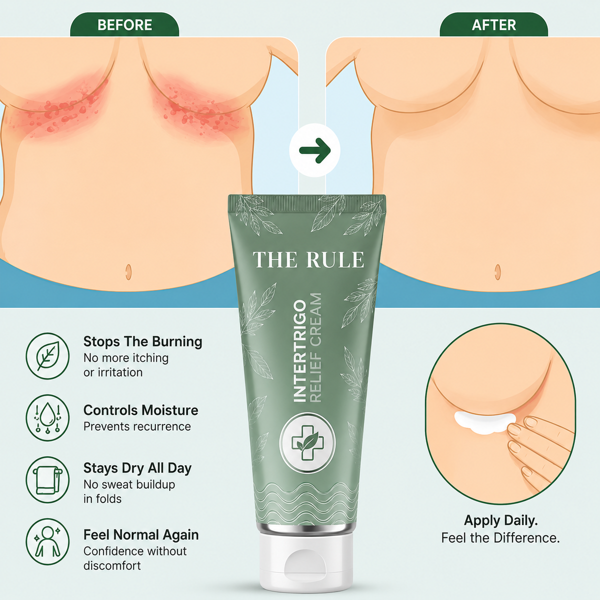 Intertrigo Care Cream